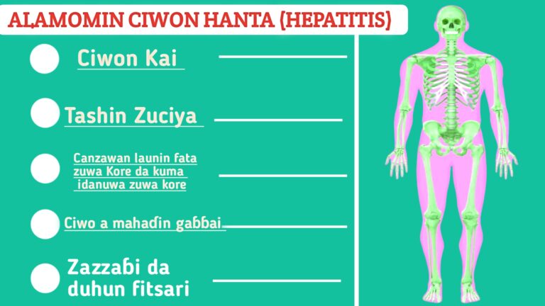 ALAMOMIN CIWON HANTA